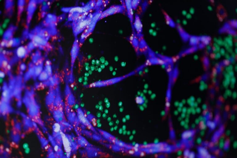 MEDV Labor Dietrich 171214 8023