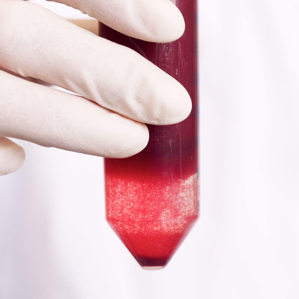 Blood sample tube for medical testing at SFB 1709.